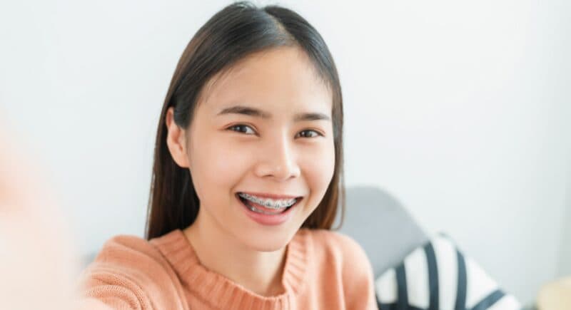 Kinh nghiệm hỗ trợ quá trình niềng răng đạt kết quả tối ưu.