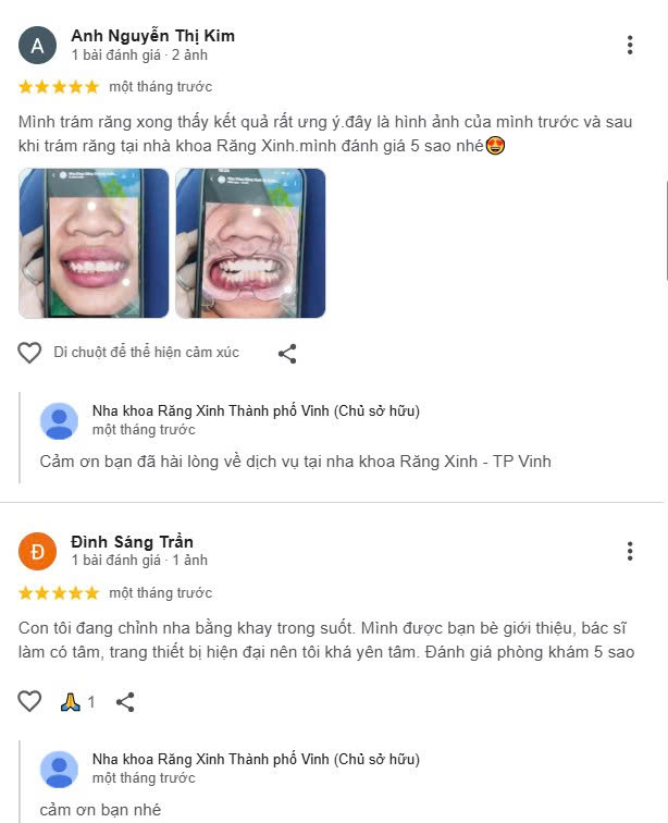 Đánh giá về Răng Xinh