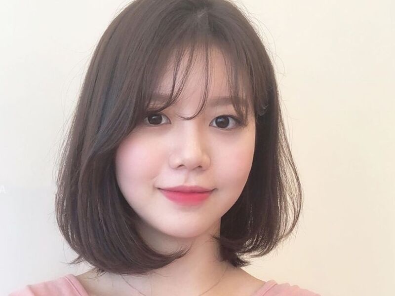 Phục hồi răng cấm giúp duy trì đường nét khuôn mặt.