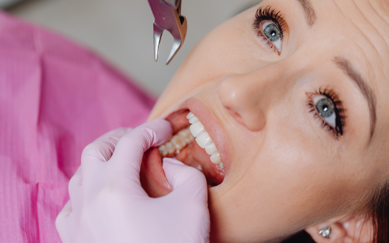 Nhổ răng giá nhiêu có thể thay đổi tùy vào nhiều yếu tố 