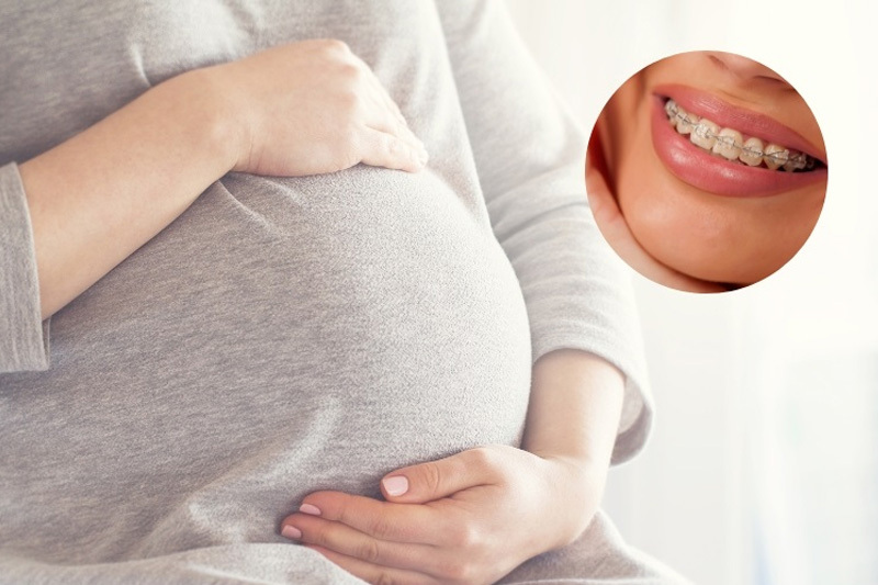 Niềng răng có ảnh hưởng đến thai nhi không? Câu trả lời là không ảnh hưởng thai nhi.