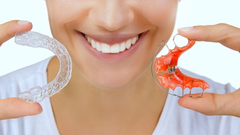 Không cần tiêm tê với trường hợp đeo hàm duy trì