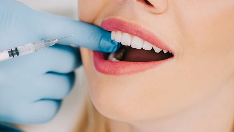 Không lạm dụng thuốc tê trong thời gian niềng răng