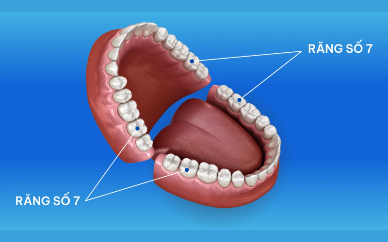 Việc quyết định có nên nhổ răng số 7 hay không phụ thuộc vào nhiều yếu tố