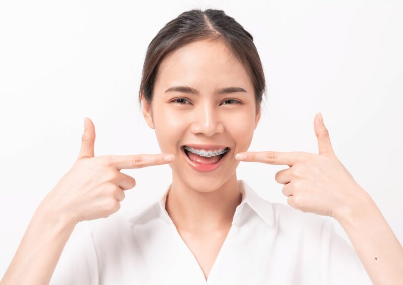 Lưỡi chưa quen với vị trí mới sau niềng răng khiến thay đổi phát âm.