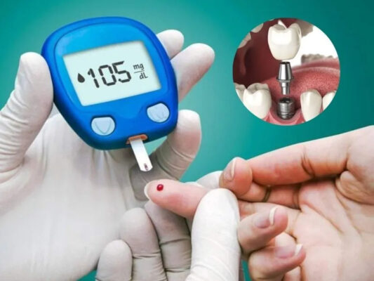 Người bị bệnh tiểu đường hoàn toàn có thể trồng răng implant