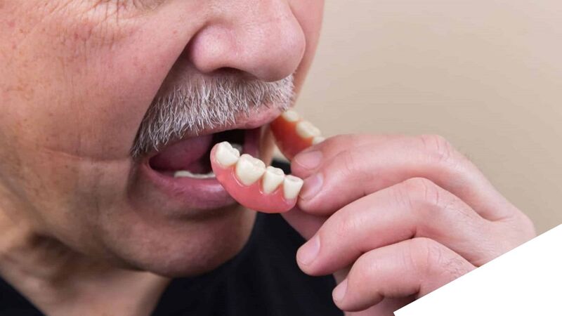 Khi răng giả trở nên lỏng lẻo, dễ rơi, cần tiến hành thay thế kịp thời.