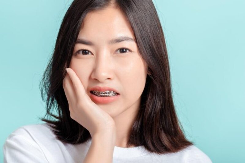 Niềng răng gây ảnh hưởng nhẹ và tạm thời trong giai đoạn đầu