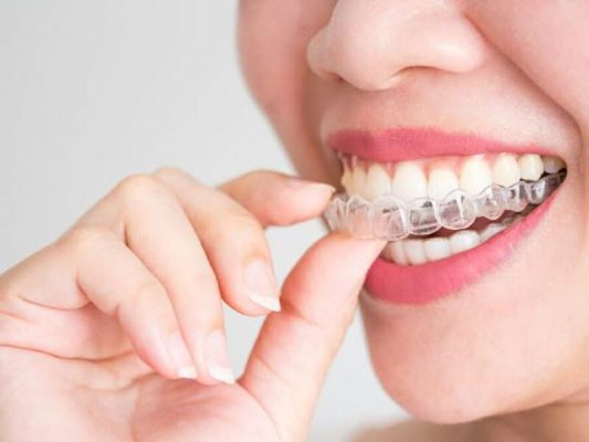 Niềng răng Invisalign có gây đau nhẹ nhưng trong ngưỡng chịu đựng được