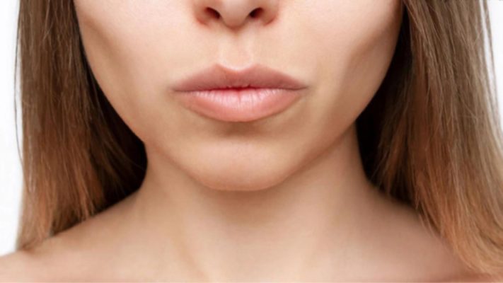 Xương gò má trông nhô cao khi vùng thái dương bị hóp