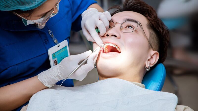 Niềng răng có bớt hô không? 3 Lưu ý khi niềng Nhổ răng số 4 để tạo khoảng kéo lùi răng cửa khi niềng răng hô