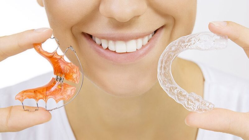 Sau khi niềng răng đeo hàm duy trì bao lâu? Bác sĩ giải đáp Người sau niềng răng đeo hàm duy trì trong 6 đến 12 tháng đầu