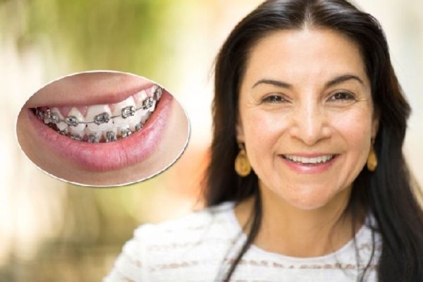 Bác sĩ kiểm tra tổng thể trước khi lên kế hoạch chỉnh nha ở tuổi 40