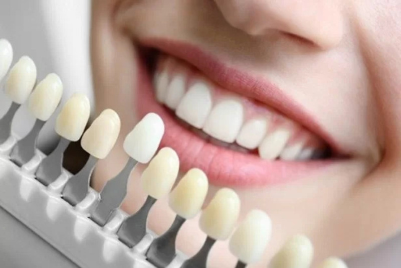 Cầu răng sứ có màu sắc và hình dáng khá giống răng thật