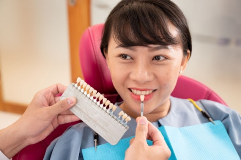 Chọn màu răng sứ phù hợp giúp tăng thẩm mỹ tổng thể